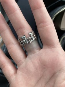 Tại sao đeo nhẫn bị xanh tay? Nguyên nhân, cách khắc phục

